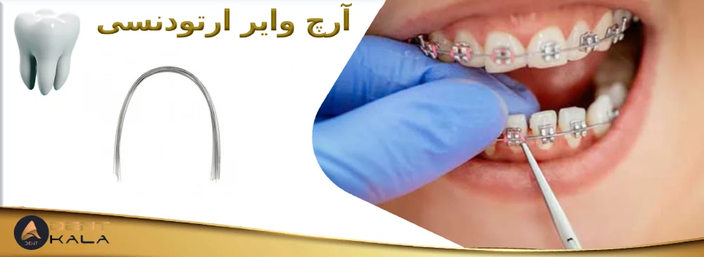آرچ وایر ارتودنسی