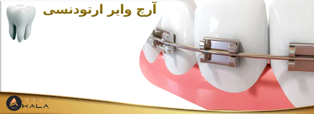 آرچ وایر ارتودنسی