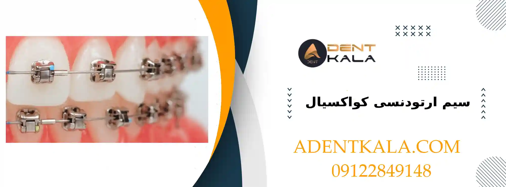 سیم ارتودنسی کواکسیال برای تنظیم دندانها با کیفیت بالا