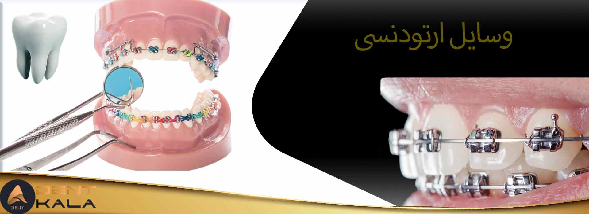 وسایل ارتودنسی