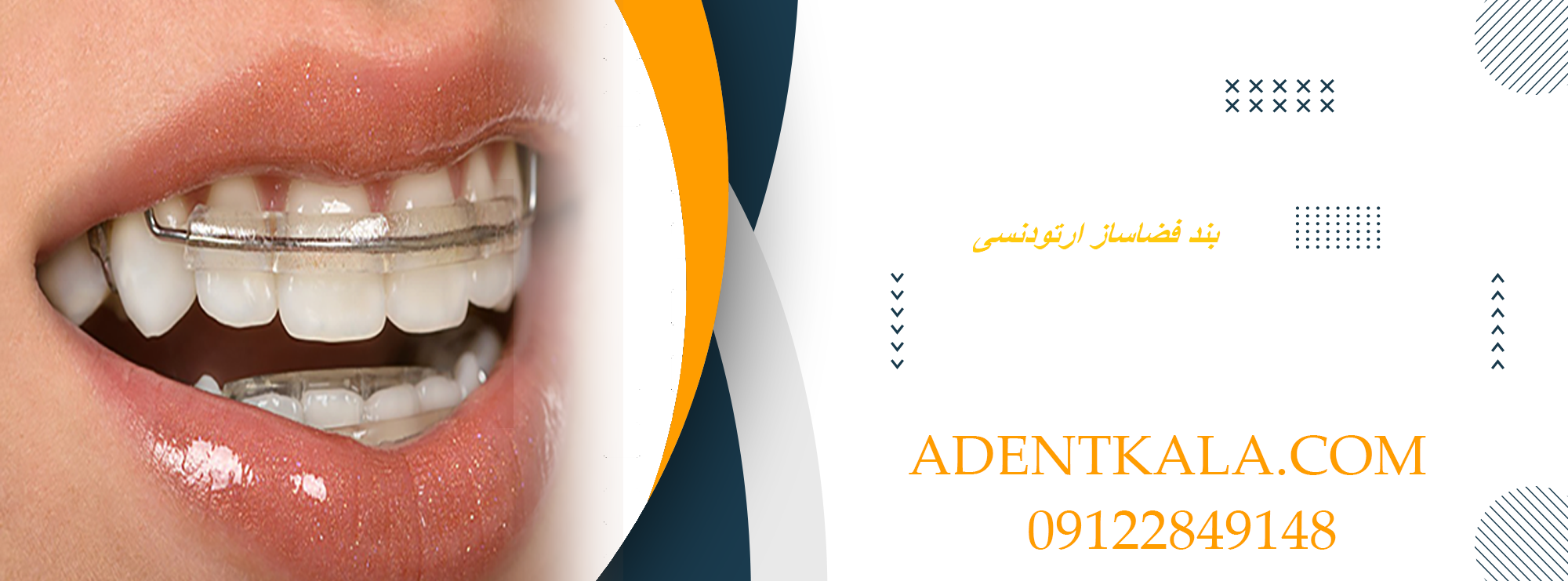 بند فضاساز ارتودنسی اطفال