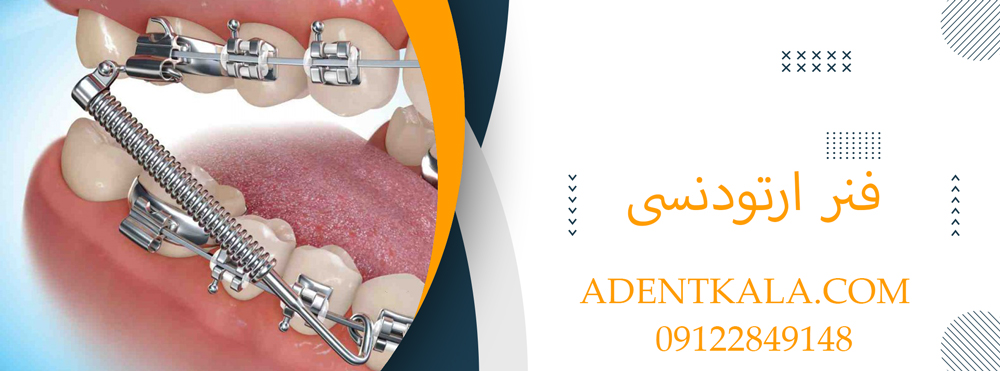 فنر ارتودنسی