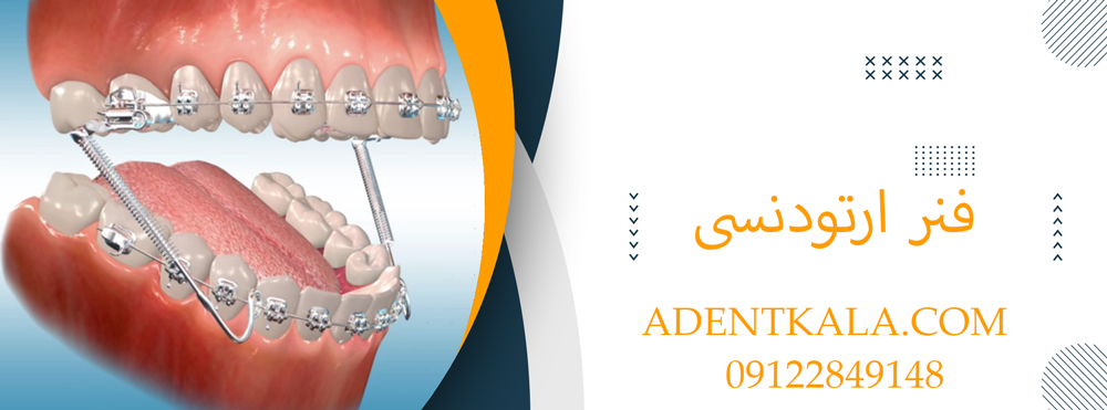 فنر ارتودنسی