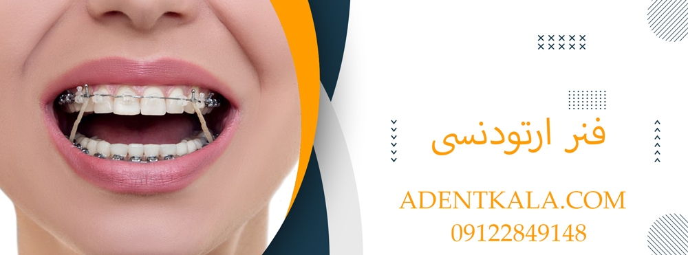 فنر ارتودنسی