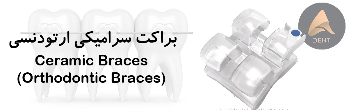 براکت سرامیکی (Ceramic Braces)