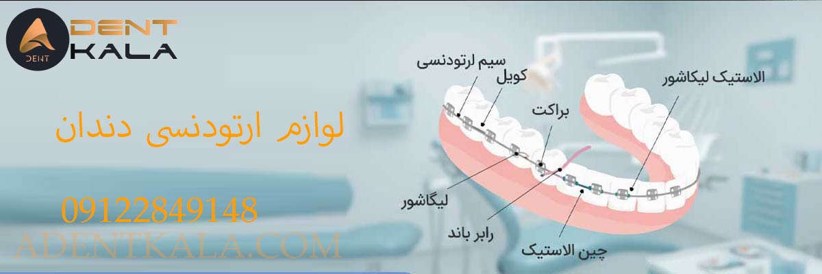 لوازم ارتودنسی دندان