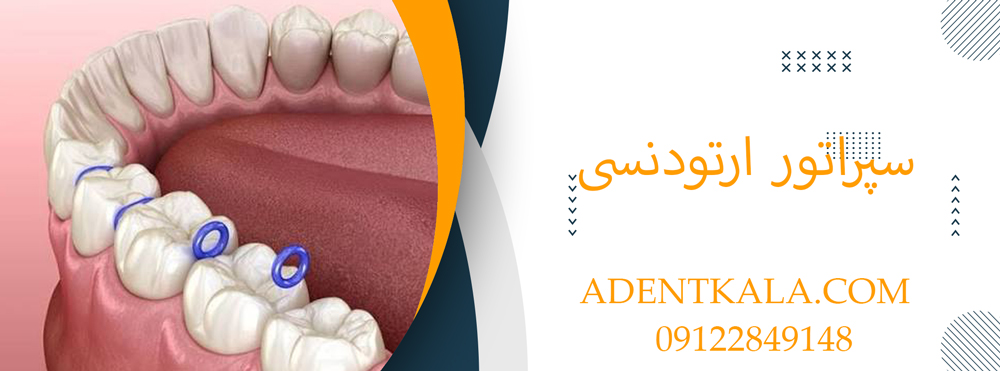 سپراتور ارتودنسی