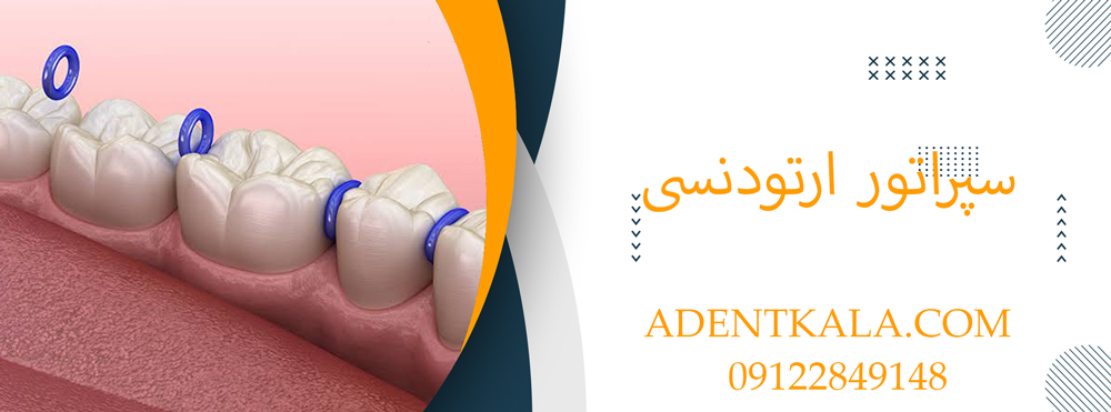 سپراتور ارتودنسی